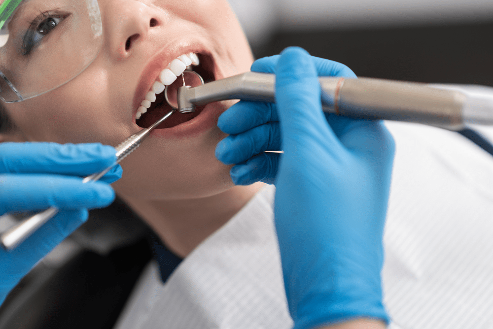 Trồng răng implant Cần Thơ